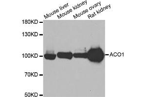 Western blot analysis of extracts of various cell lines, using ACO1 antibody (ABIN5973578) at 1/500 dilution. (Aconitase 1 antibody)