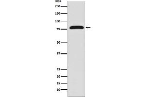 Western blot analysis of TGM2 expression in HUVEC cell lysate.