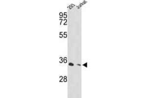 Western Blotting (WB) image for anti-Proteasome (Prosome, Macropain) 26S Subunit, Non-ATPase, 11 (PSMD11) antibody (ABIN3001640) (PSMD11 antibody)