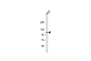 Anti-DEF Antibody (N-term) at 1:2000 dilution + A431 whole cell lysate Lysates/proteins at 20 μg per lane. (ZC3H18 antibody  (N-Term))