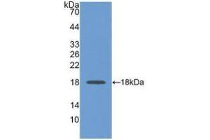 Detection of Recombinant GAPDH, Human using Monoclonal Antibody to Glyceraldehyde-3-Phosphate Dehydrogenase (GAPDH) (GAPDH antibody  (AA 2-148))