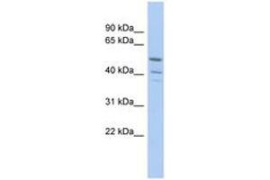 Image no. 1 for anti-Tripartite Motif Containing 50 (TRIM50) (AA 251-300) antibody (ABIN6742478) (TRIM50 antibody  (AA 251-300))