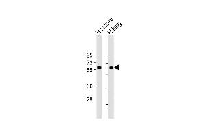 All lanes : Anti-MKS1 Antibody (N-Term) at 1:2000 dilution Lane 1: Human kidney lysate Lane 2: Human lung lysate Lysates/proteins at 20 μg per lane. (MKS1 antibody  (AA 90-124))