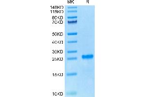 Cynomolgus PS20 on Tris-Bis PAGE under reduced condition. (WFDC1 Protein (AA 32-192) (His tag))