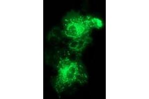 Anti-MMAB mouse monoclonal antibody (ABIN2454036) immunofluorescent staining of COS7 cells transiently transfected by pCMV6-ENTRY MMAB (RC204290). (MMAB antibody)