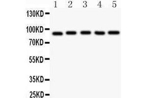 Western Blotting (WB) image for anti-Aryl Hydrocarbon Receptor Nuclear Translocator (ARNT) (AA 416-789) antibody (ABIN3043528)