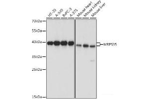 Western blot analysis of extracts of various cell lines using MRPS35 Polyclonal Antibody at dilution of 1:1000.