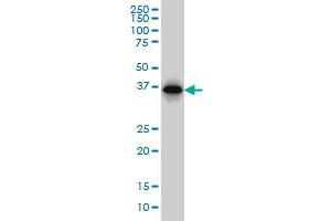 RP2 monoclonal antibody (M02), clone 5C10 Western Blot analysis of RP2 expression in Hela S3 NE . (RP2 antibody  (AA 251-350))