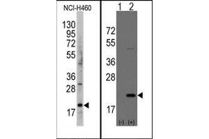 Image no. 1 for anti-Anterior Gradient Homolog 2 (Xenopus Laevis) (AGR2) (AA 102-132) antibody (ABIN358784) (AGR2 antibody  (AA 102-132))