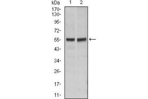 Western blot analysis using FAS antibody against Hela (1), Jurkat (2) cell lysate. (FAS antibody)