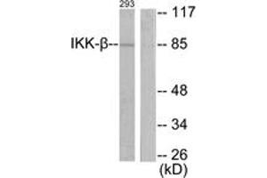 Western blot analysis of extracts from 293 cells, treated with LPS 100ng/ml 30', using IKK-beta (Ab-188) Antibody. (IKBKB antibody  (AA 161-210))