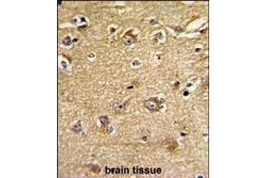 Formalin-fixed and paraffin-embedded human brain tissue reacted with IT Antibody (Center), which was peroxidase-conjugated to the secondary antibody, followed by DAB staining. (IMMT antibody  (AA 438-467))