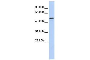 CHEK1 antibody used at 1 ug/ml to detect target protein. (CHEK1 antibody)