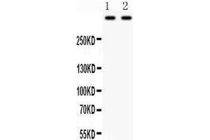 Western Blotting (WB) image for anti-Plectin (PLEC) (AA 2644-2671), (Middle Region) antibody (ABIN3043900) (PLEC antibody  (Middle Region))