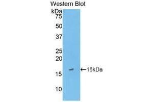 Detection of Recombinant FABP3, Human using Monoclonal Antibody to Heart-type Fatty Acid Binding Protein (H-FABP)