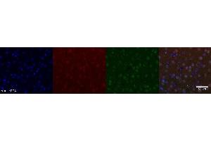 Immunohistochemistry (IHC) image for anti-Nuclear Receptor Subfamily 4, Group A, Member 2 (NR4A2) antibody (ABIN7456241) (NR4A2 antibody)