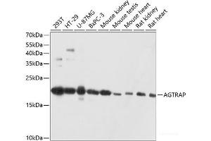 Western blot analysis of extracts of various cell lines using AGTRAP Polyclonal Antibody at dilution of 1:3000. (AGTRAP antibody)