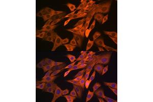 Immunofluorescence analysis of NIH-3T3 cells using SRP54 Rabbit mAb (ABIN3015958, ABIN3015959, ABIN1682276, ABIN1682277 and ABIN7101466) at dilution of 1:100 (40x lens). (SRP54 antibody)