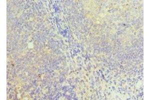 Immunohistochemistry of paraffin-embedded human tonsil tissue using ABIN7149352 at dilution of 1:100 (NCK1 antibody  (AA 58-377))