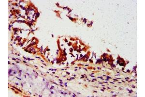 IHC image of ABIN7162284 diluted at 1:500 and staining in paraffin-embedded human lung tissue performed on a Leica BondTM system. (ORMDL3 antibody  (AA 43-94))