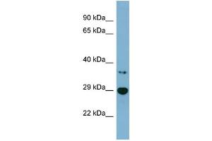 Western Blotting (WB) image for anti-3-hydroxybutyrate Dehydrogenase, Type 2 (BDH2) (Middle Region) antibody (ABIN2787189)