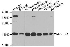 Western blot analysis of extracts of various cell lines, using NDUFB5 antibody. (NDUFB5 antibody  (AA 100-189))