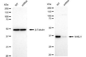 Western blotting analysis using NHEJ1 antibody (ABIN7799623). (Recombinant NHEJ1 antibody)