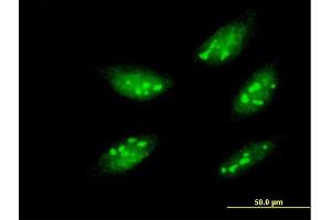 Immunofluorescence of monoclonal antibody to MEOX1 on HeLa cell. (MEOX1 antibody  (AA 165-252))