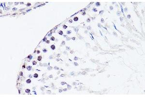 Immunohistochemistry of paraffin-embedded Rat testis using FGF12 Polyclonal Antibody at dilution of 1:150 (40x lens). (FGF12 antibody)