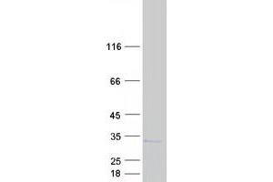 Validation with Western Blot