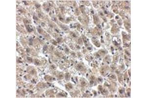 Immunohistochemistry of Albumin in human liver tissue with Albumin antibody at 2. (Albumin antibody  (Center))