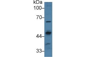 Detection of PPM1A in Human 293T cell lysate using Polyclonal Antibody to Protein Phosphatase, Mg2+/Mn2+ Dependent 1A (PPM1A) (PPM1A antibody  (AA 2-382))