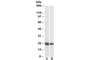 Western blot testing of human A) thymus and B) tonsil lysate with RAC2 antibody at 0. (RAC2 antibody)