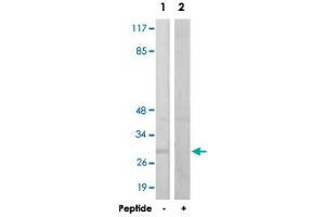 Western blot analysis of extracts from HUVEC cells, using IGFBP3 polyclonal antibody . (IGFBP3 antibody  (Ser183))