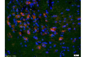 Formalin-fixed and paraffin-embedded rat brain labeled with Anti-KLF5/UKHC Polyclonal Antibody, Unconjugated (ABIN739515) 1:200, overnight at 4°C, The secondary antibody was Goat Anti-Rabbit IgG, Cy3 conjugated used at 1:200 dilution for 40 minutes at 37°C. (KLF5 antibody  (AA 61-160))