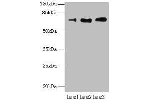 Western blot All lanes: CD180 antibody at 3. (Integrin beta 2 antibody  (AA 24-220))