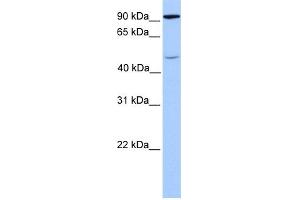 WB Suggested Anti-STAT5B Antibody Titration: 1 ug/ml Positive Control: Fetal Brain Lysate (STAT5B antibody  (C-Term))