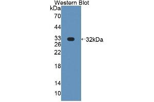 Western blot analysis of the recombinant protein. (PLCH1 antibody  (AA 1-237))