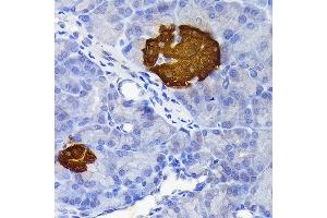 Immunohistochemistry of paraffin-embedded rat pancreatic islet using Secretagogin (Secretagogin (SCGN)) Rabbit mAb (ABIN7270178) at dilution of 1:100 (40x lens). (SCGN antibody)