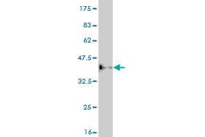 Western Blot detection against Immunogen (36. (ASCL1 antibody  (AA 137-236))