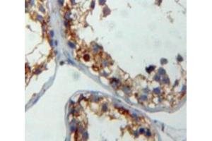 Used in DAB staining on fromalin fixed paraffin-embedded testis tissue (CITED1 antibody  (AA 1-193))
