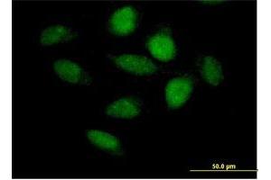 Immunofluorescence of purified MaxPab antibody to APBB3 on HeLa cell. (APBB3 antibody  (AA 1-486))