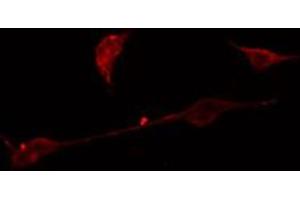ABIN6275050 staining A549 cells by IF/ICC. (AGBL4 antibody  (C-Term))