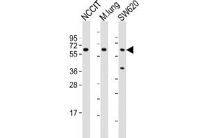 All lanes : Anti-TGFBR2 Antibody (N-term) at 1:2000 dilution Lane 1: NCCIT whole cell lysates Lane 2: mouse lung lysates Lane 3: S whole cell lysates Lysates/proteins at 20 μg per lane.