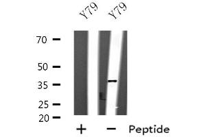 Western blot analysis of extracts of Y79 cell lines, using SPARC antibody. (SPARC antibody  (Internal Region))