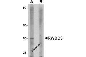 Western Blotting (WB) image for anti-RWD Domain Containing 3 (RWDD3) (C-Term) antibody (ABIN1030633) (RWDD3 antibody  (C-Term))