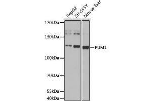 Western blot analysis of extracts of various cell lines, using pum1 antibody (ABIN6293483) at 1:1000 dilution. (PUM1 antibody)