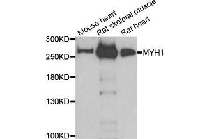 Western blot analysis of extracts of various cell lines, using MYH1 antibody. (MYH1 antibody)