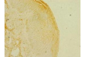 Immunohistochemistry of paraffin-embedded human skin tissue using ABIN7157698 at dilution of 1:100 (KREMEN1 antibody  (AA 180-380))