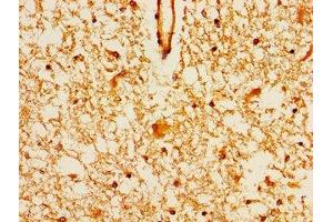Immunohistochemistry of paraffin-embedded human brain tissue using ABIN7159356 at dilution of 1:100